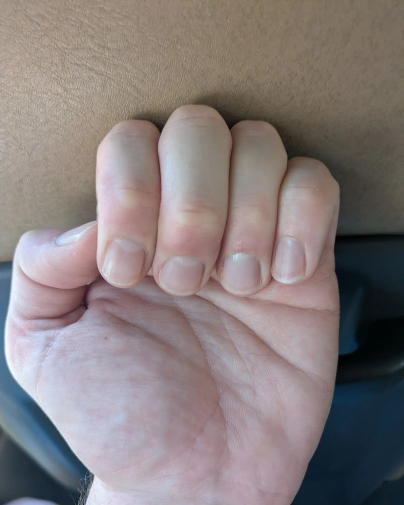 Fingers After Using Controlled Hands
